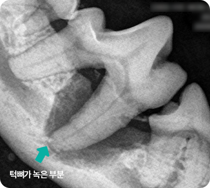 턱뼈 녹음