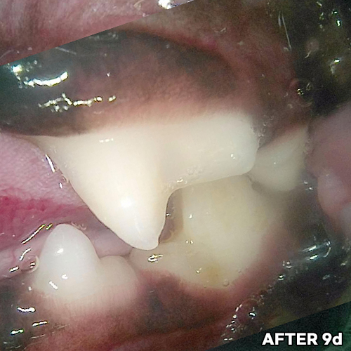 샘플
