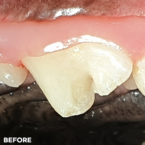 샘플