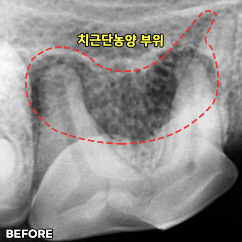 샘플 이미지