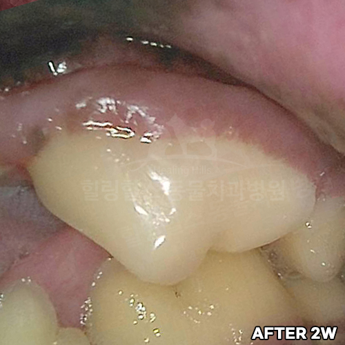 샘플 이미지