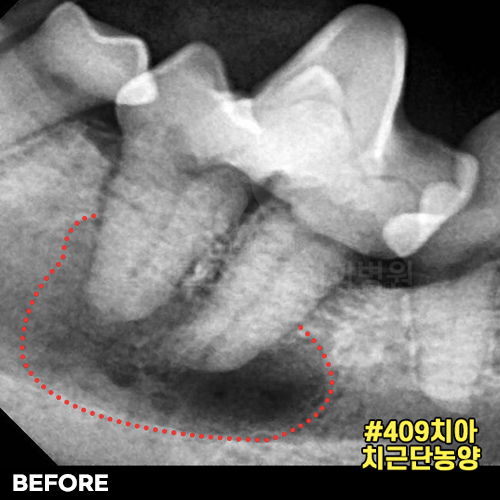 샘플 이미지