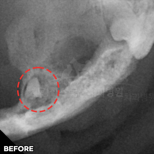 샘플 이미지